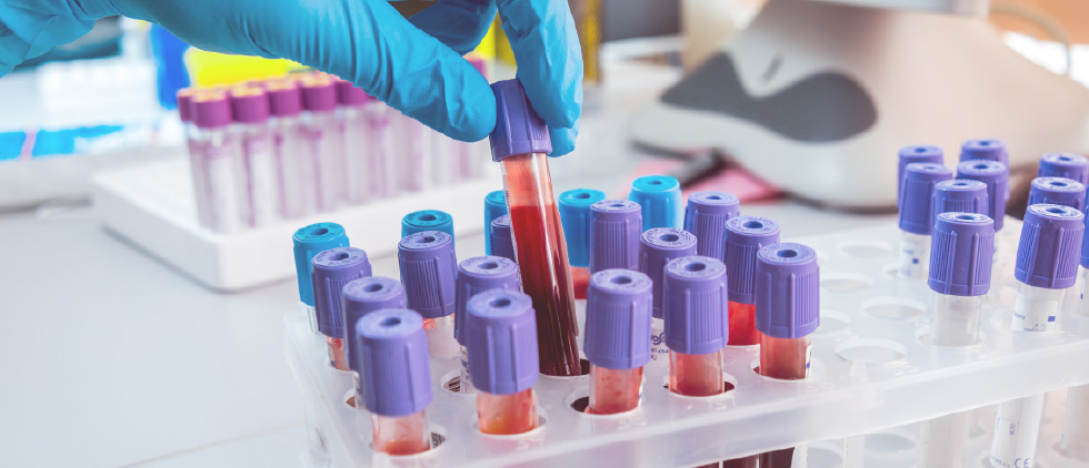 Symptoms, signs and abnormal clinical and laboratory findings, not elsewhere classified 